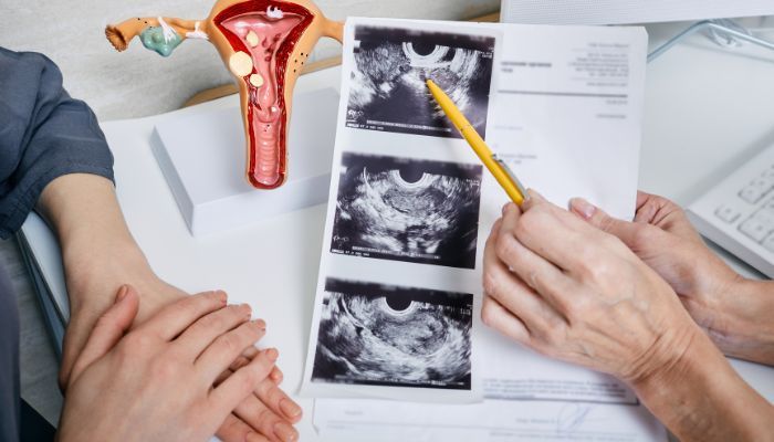 Các yếu tố suy giảm chất lượng trứng