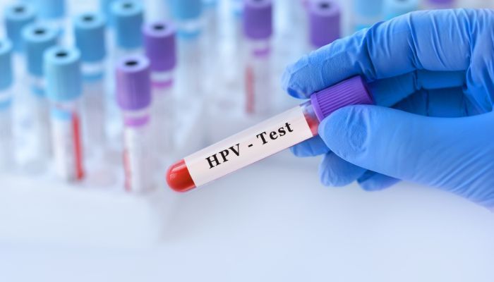virus hpv