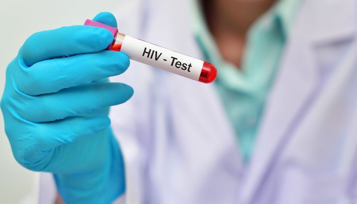 Xét nghiệm HIV thời gian nào là hợp lí